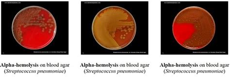 beta hemolysis vs alpha|ALPHA AND BETA HEMOLYTIC STREPTOCOCCUS .